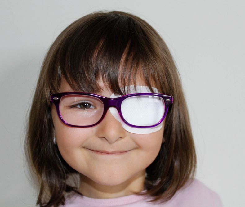 What causes amblyopia?