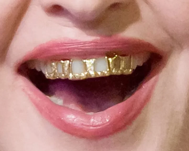 Everything You Need to Know About Wearing Grillz